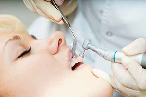 Phoenix family dentist | teeth cleaning | Dr. Jakobsen