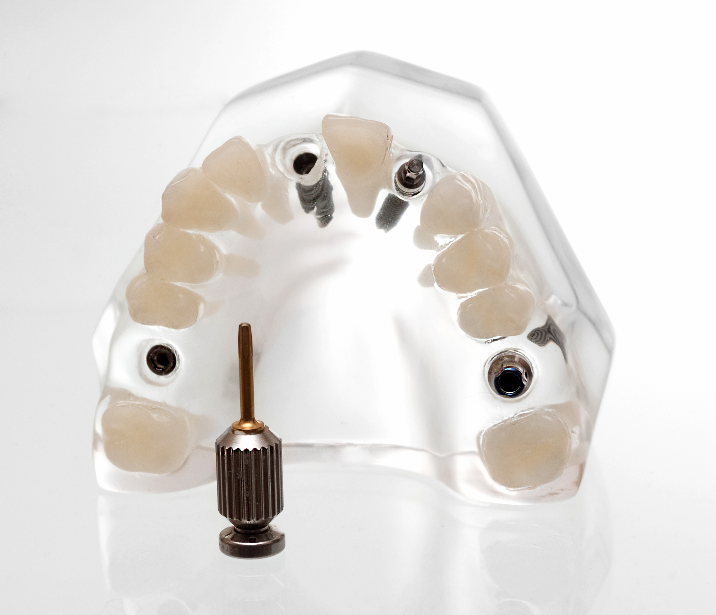 Phoenix cosmetic dentist | dental implants, restoration | Dr. Jakobsen